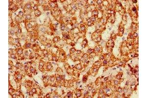 Immunohistochemistry of paraffin-embedded human liver tissue using ABIN7159651 at dilution of 1:100 (ALDH6A1 anticorps  (AA 274-399))