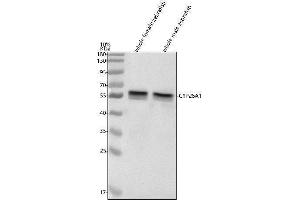 Western blot analysis of CYP26A1 using anti-CYP26A1 antibody (A).