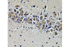 Immunohistochemistry of paraffin-embedded Mouse brain using PLCG1 Polyclonal Antibody at dilution of 1:100 (40x lens).
