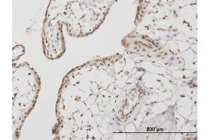 Immunoperoxidase of monoclonal antibody to RUNX1 on formalin-fixed paraffin-embedded human placenta.