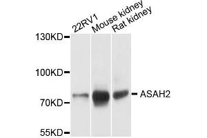 Western blot analysis of extracts of mouse testis, using ASAH2 antibody. (ASAH2 anticorps)