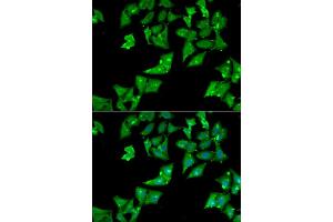 Immunofluorescence analysis of HeLa cell using AGA antibody. (AGA anticorps)