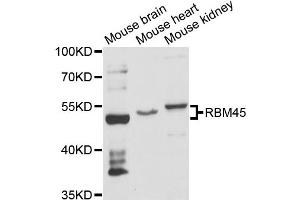 Western blot analysis of extracts of various cell lines, using RBM45 antibody (ABIN6290880) at 1:3000 dilution.
