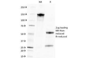SDS-PAGE Analysis of Purified, BSA-Free CMV Antibody (clone CMV100). (Cytomegalovirus (CMV) anticorps)