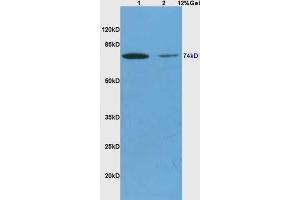 Lane 1: mouse brain lysates Lane 2: mouse heart lysates probed with Anti ALOX15B/15 Lipoxygenase 2 Polyclonal Antibody, Unconjugated (ABIN873138) at 1:200 in 4 °C. (ALOX15B anticorps  (AA 13-110))