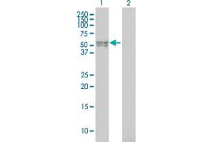 Western Blot analysis of BMPR1B expression in transfected 293T cell line by BMPR1B monoclonal antibody (M02), clone 3A8.