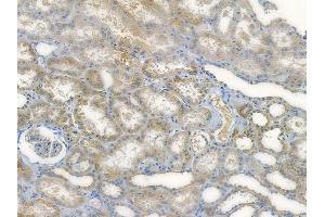 ABIN7096004 and ABIN7100066 at 1/100 staining human normal kidney tissue by IHC-P. (HERC3 anticorps)