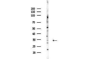 Western blot analysis of lysates from F10-LUC cells(heat-shock,45 min treatment), using IL20RB Antibody at 1/1000 dilution.