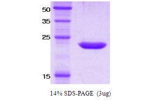 SDS-PAGE (SDS) image for Killer Cell Immunoglobulin-Like Receptor, Two Domains, Short Cytoplasmic Tail, 4 (KIR2DS4) protein (ABIN666835) (KIR2DS4 Protéine)