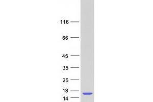 Validation with Western Blot
