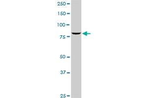 SP1 monoclonal antibody (M05), clone 4B11.