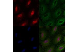 ABIN6260045 and ABIN6276424 staining  cells by IF/ICC.