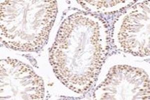 Immunohistochemistry analysis of paraffin-embedded mouse testis using,NUDT22 (ABIN7074928) at dilution of 1: 7200 (NUDT22 anticorps)