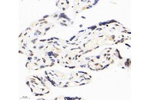 Immunohistochemistry analysis of paraffin-embedded human placenta using,RBM14 (ABIN7075474) at dilution of 1: 2000 (RBM14 anticorps)