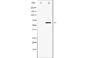 Western blot analysis of PDK1 expression in EGF treated MDA-MB-435 whole cell lysates,The lane on the left is treated with the antigen-specific peptide. (PDPK1 anticorps  (Internal Region))