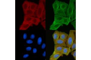 ABIN6256606 and ABIN6268850 staining Hela cells(30 min of UV treatment) by IF/ICC. (DCT anticorps  (N-Term))