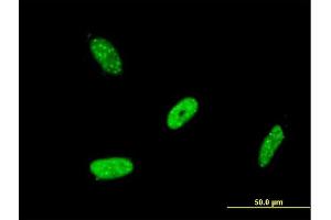 Immunofluorescence of monoclonal antibody to RBMS2 on HeLa cell. (RBMS2 anticorps  (AA 308-407))