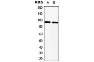 Western blot analysis of TLE2 expression in HeLa (A), Jurkat (B) whole cell lysates. (TLE2 anticorps  (Center))