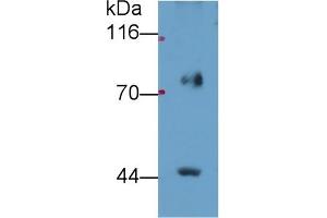 Detection of FADS2 in Porcine Lung lysate using Polyclonal Antibody to Fatty Acid Desaturase 2 (FADS2) (FADS2 anticorps  (AA 1-130))
