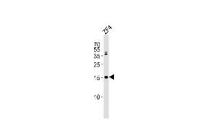 Anti-gabarapl2 Antibody (N-term) at 1:2000 dilution + ZF4 whole cell lysates Lysates/proteins at 20 μg per lane. (GABARAPL2 anticorps  (N-Term))