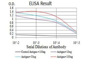 Black line: Control Antigen (100 ng), Purple line: Antigen(10 ng), Blue line: Antigen (50 ng), Red line: Antigen (100 ng), (Histone Cluster 2, H3c (HIST2H3C) (acLys27) anticorps)