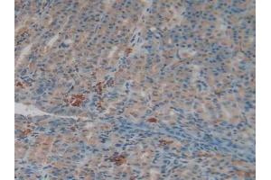 Detection of F2 in Rat Intestine Tissue using Polyclonal Antibody to Coagulation Factor II (F2)