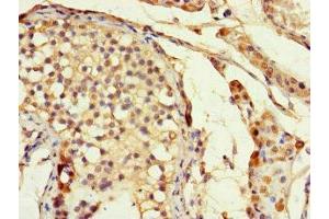 Immunohistochemistry of paraffin-embedded human testis tissue using ABIN7155679 at dilution of 1:100 (DLX5 anticorps  (AA 1-249))