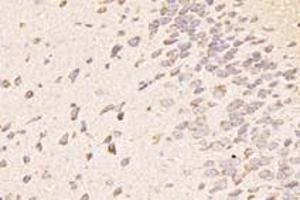Immunohistochemistry analysis of paraffin-embedded mouse striatum using,TTL (ABIN7076048) at dilution of 1: 4000 (TTL anticorps)