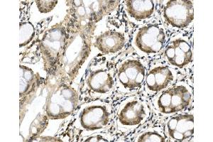 IHC analysis of ITCH/AIP4 using anti-ITCH/AIP4 antibody (ABIN7600264).