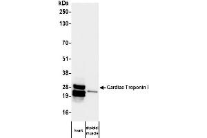 Western Blotting (WB) image for anti-Cardiac Troponin I (TNNI3) antibody (ABIN7795607)