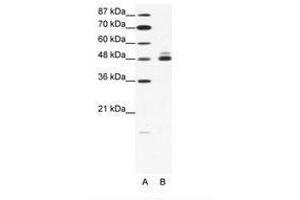 Image no. 1 for anti-Cholinergic Receptor, Nicotinic, beta 2 (Neuronal) (CHRNB2) (AA 21-70) antibody (ABIN202670) (CHRNB2 anticorps  (AA 21-70))