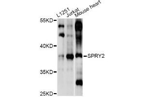 Western blot analysis of extracts of various cell lines, using SPRY2 antibody (ABIN6293587) at 1:1000 dilution. (SPRY2 anticorps)
