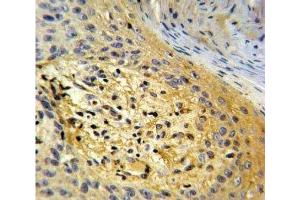 IHC analysis of FFPE human skin tissue stained with SPARC antibody