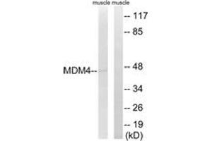 Western blot analysis of extracts from rat muscle cells, using MDM4 (Ab-367) Antibody. (MDM4-binding Protein anticorps  (AA 336-385))