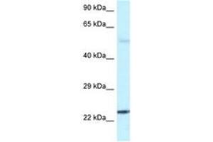 Image no. 1 for anti-RAB31, Member RAS Oncogene Family (RAB31) (C-Term) antibody (ABIN6747504) (RAB31 anticorps  (C-Term))