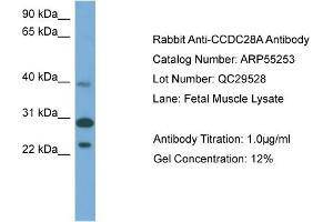 WB Suggested Anti-CCDC28A  Antibody Titration: 0. (CCDC28A anticorps  (Middle Region))