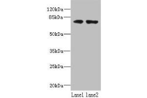 Western blot All lanes: WDTC1 antibody at 1. (WDTC1 anticorps  (AA 201-420))