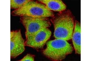 Fluorescent confocal image of U251 cell stained with RELA antibody at 1:25.