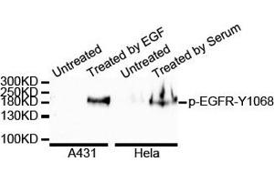 Western blot analysis of extracts of various cell lines, using Phospho-EGFR-Y1068 antibody. (EGFR anticorps  (pTyr1092))