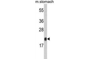 Western Blotting (WB) image for anti-FK506 Binding Protein 11, 19 KDa (FKBP11) antibody (ABIN3002801) (FKBP11 anticorps)