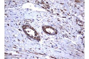 Image no. 4 for anti-Tumor Necrosis Factor Receptor Superfamily, Member 8 (TNFRSF8) (AA 19-379) antibody (ABIN1491084)