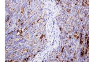 Immunohistochemistry (IHC) image for anti-Temporarily Assigned Gene Name Family Member (TAG-72) antibody (ABIN2669952) (TAG-72 anticorps)