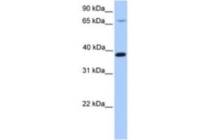 Western Blotting (WB) image for anti-Hydroxymethylbilane Synthase (HMBS) antibody (ABIN2463631) (HMBS anticorps)