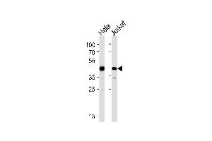 Western blot analysis in Hela,Jurkat cell line lysates (35ug/lane). (ACTR2 anticorps  (AA 191-219))