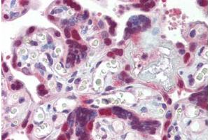 Placenta, Human: Formalin-Fixed, Paraffin-Embedded (FFPE)