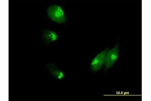 Immunofluorescence of purified MaxPab antibody to NUCB1 on HeLa cell.