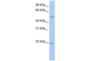 WB Suggested Anti-SDCBP2 Antibody Titration: 0. (SDCBP2 anticorps  (N-Term))