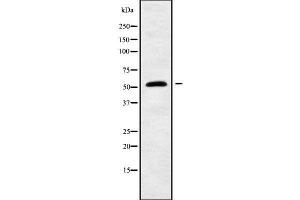 Western blot analysis of RASGEF1A using COLO205 whole cell lysates (RASGEF1A anticorps  (Internal Region))
