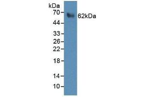 WB analysis of recombinant Human PRF1 Protein, using Rabbit anti-Human PRF1 antibody (abx100625). (Perforin 1 Protéine)