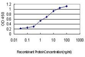 Detection limit for recombinant GST tagged N4BP2 is approximately 0.